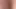 sop 086