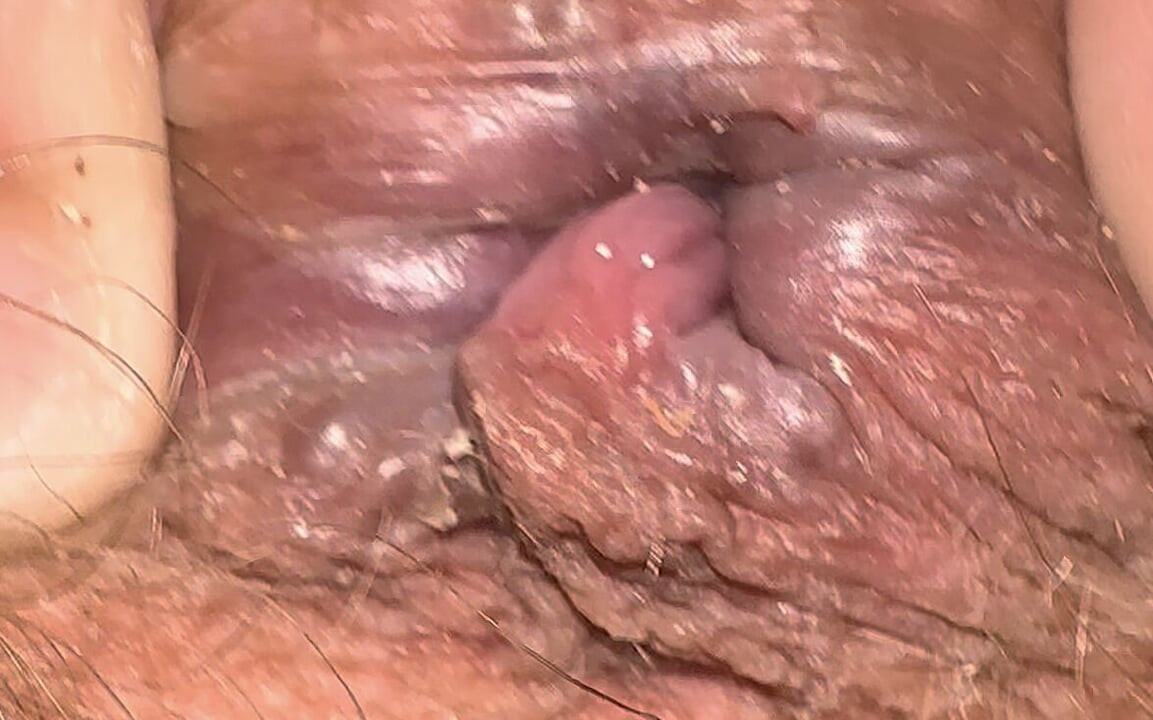 Hole Play