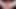 Masturbation prostata vibrator