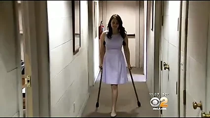 Anna – RHP Amputee on Crutches