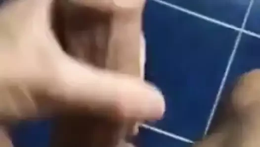 Sünnet derisi