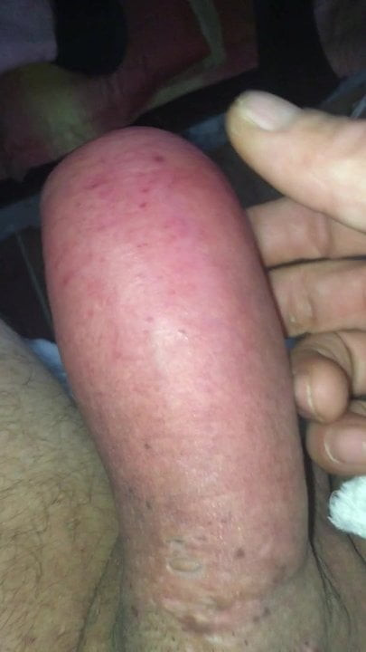 Pumped cock