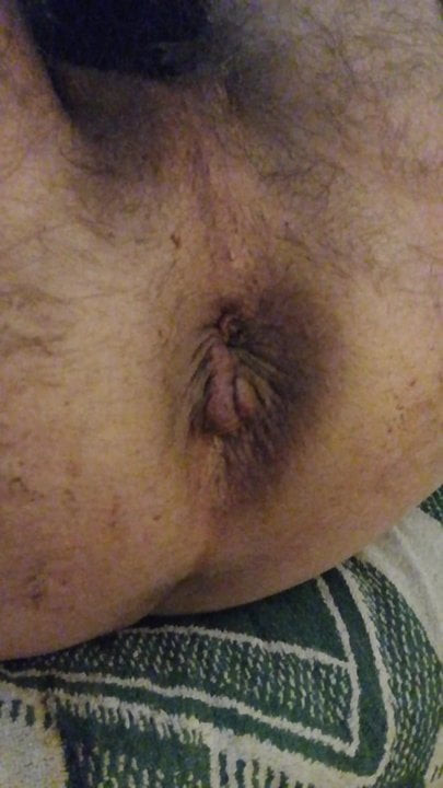 My hole