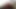 Bald Black Bitch Suck BIG White Cock