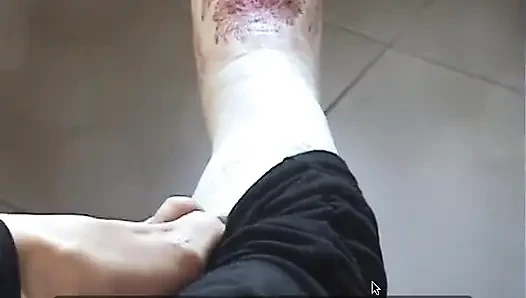 Legcast and...barefoot