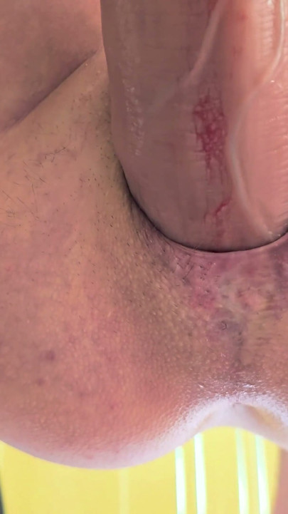 Extreme Endurance Test Pushing Out to a Rosebud - Extreme Anal Gape!