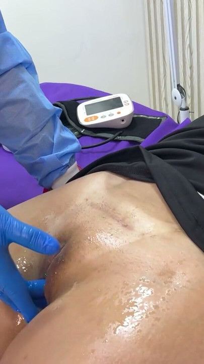 Gynecologist checks the ovary and ends up going deep into the patient's vagina | Clip 2