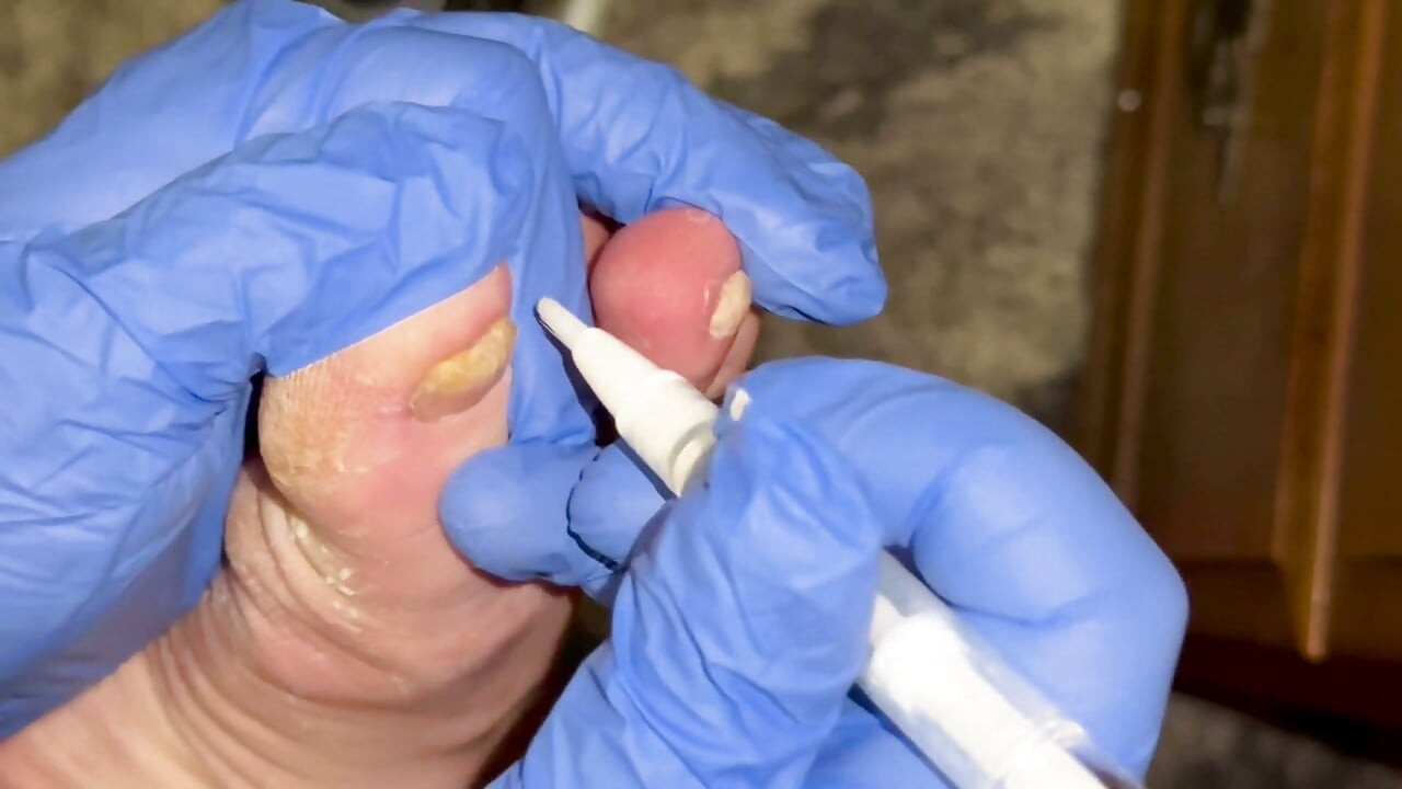 Crusty Foot Care and Worship - FTM