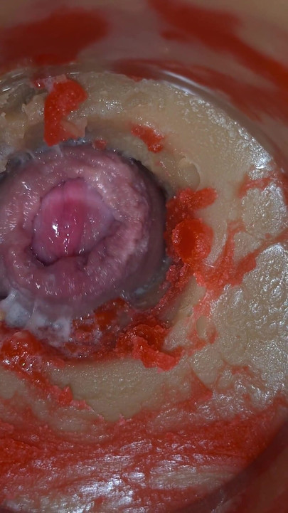 Insemination - Internal Camera Captures Deep Male Ejaculation