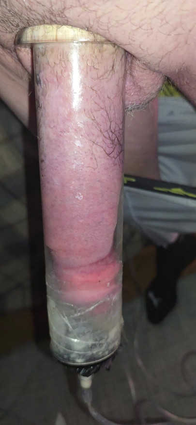 Play with my penis pump