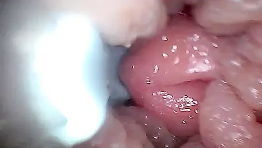 Visueller Leitfaden Für G-punkt-stimulation Und Orgasmus-endoskopische Perspektive