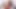 18-jährige Teenager Zusammenstellung PMV von Dimecum