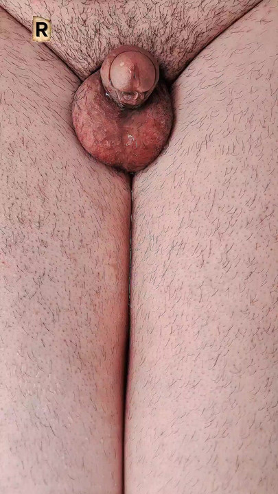 My wet penis is urinating."