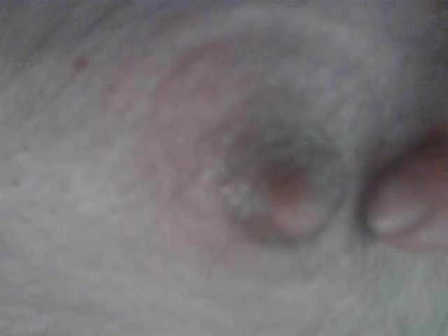 Nipples