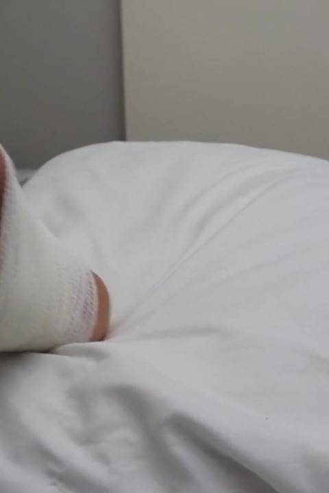 I Sprained My Ankle