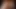 Mz berlin teaser