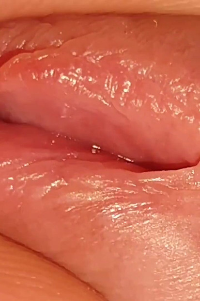 How to Widen a Glans Hole to the Extreme.