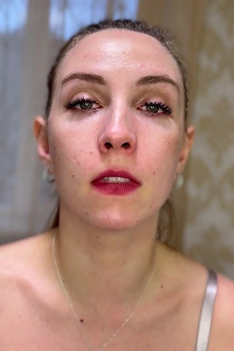 Nonstop Sneezing Watch My Nose Go Wild