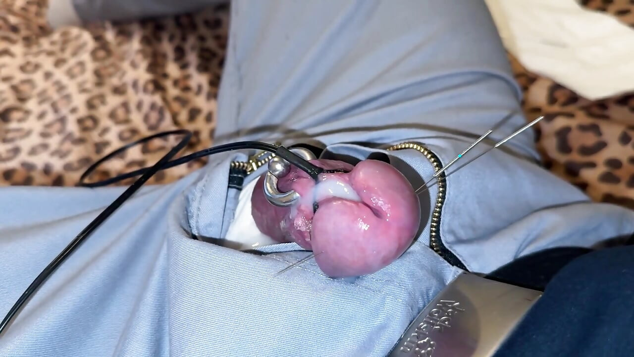 الإبر المنوية