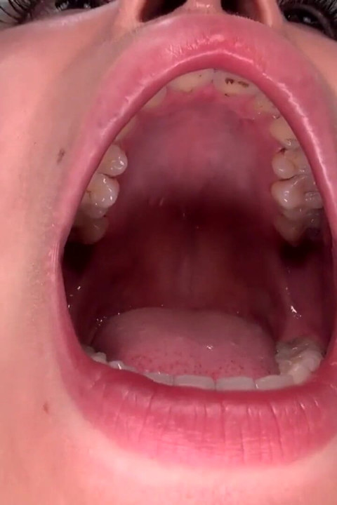 Teeth Examination - Beauty Unveiled