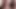 Masturbation anal