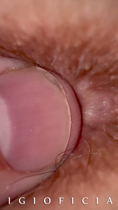EXTREME CLOSE UP: Milf stands doggy style. She wants you to enjoy her butthole liking! | Clip 1