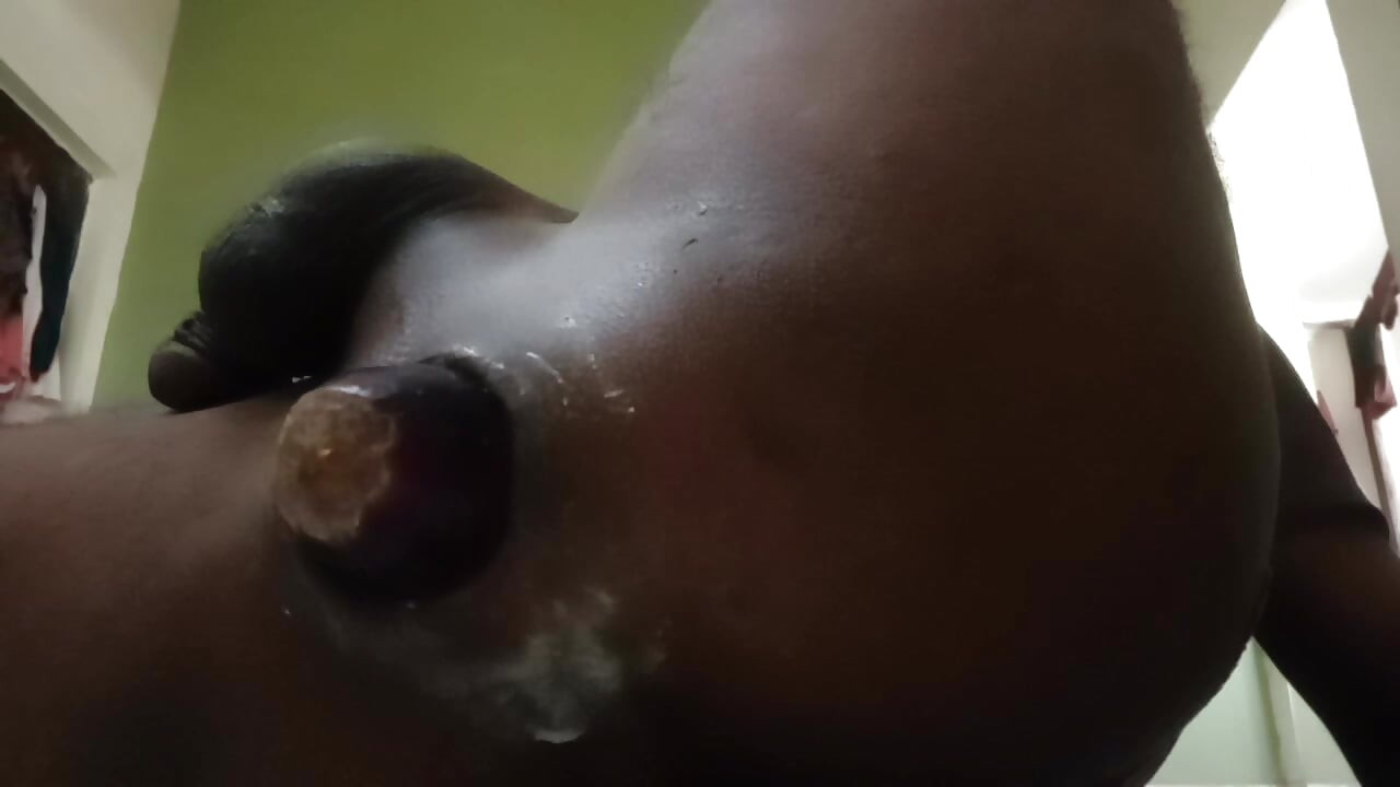 Anal sex