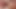 Anal ve pissing tedavi itibaren expirienced bbw hemşire