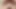 66 yo man from Germany