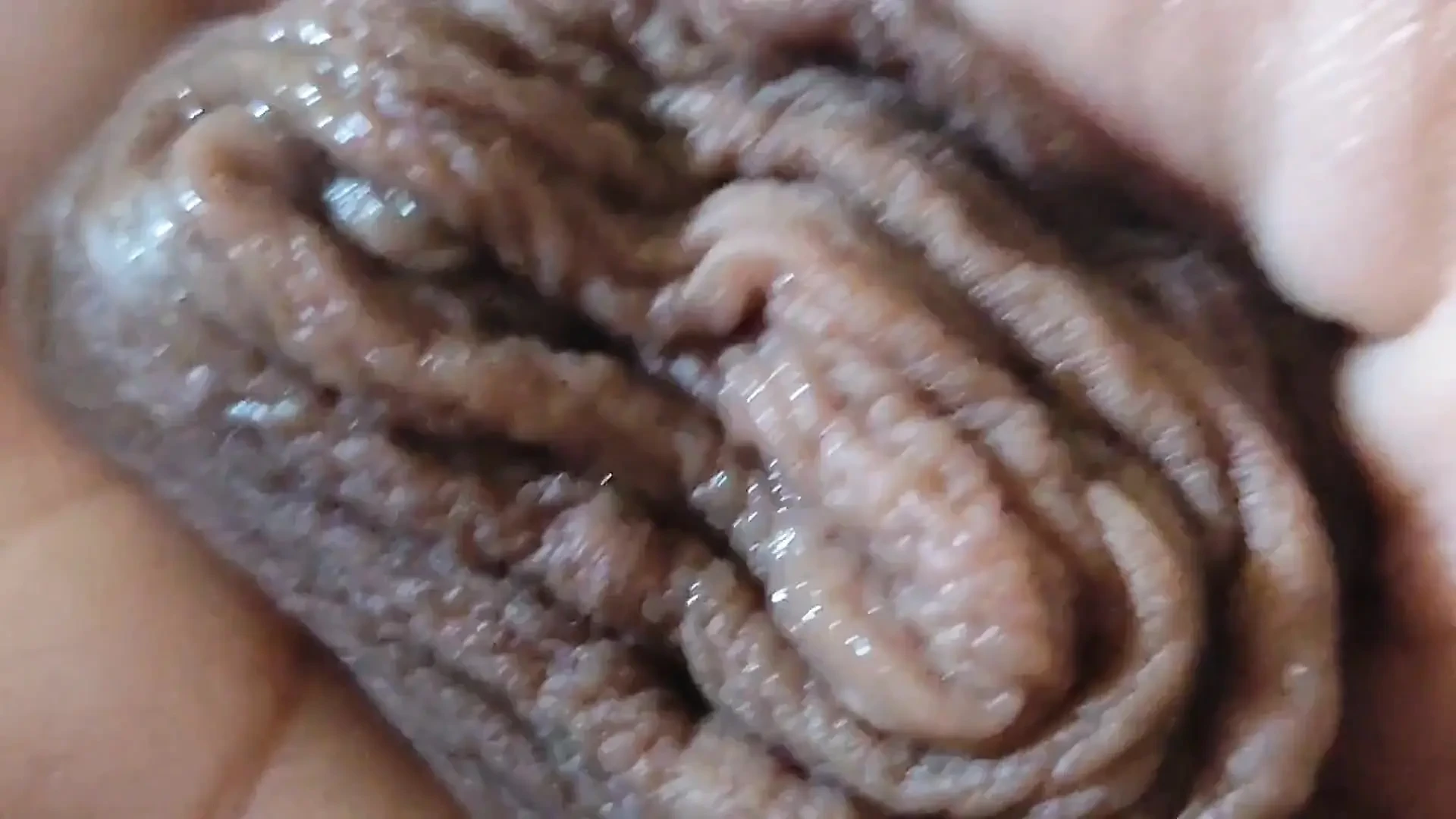 Immense Phimosis Being Extracted Cum and Précum.