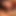 Tgirl prolapse azdırıyor rosebud ıslak dışarı çıkıyor
