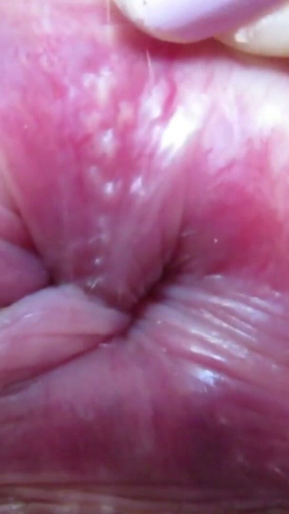 Asshole exteme closeup ass fetish anal | Clip 1