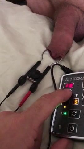 Electro Stim Bill Mantri