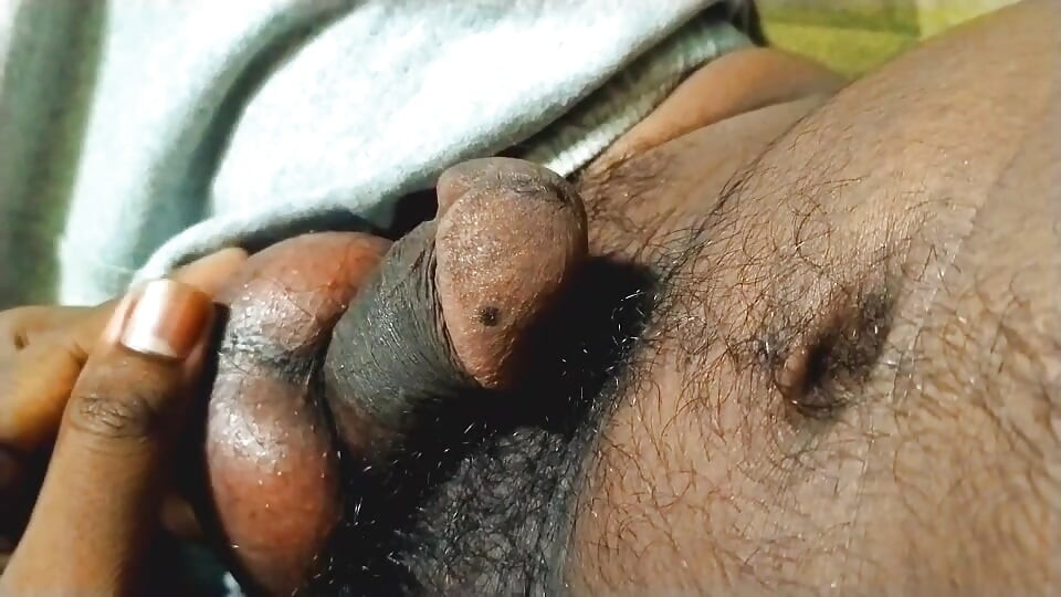 Hairy ball