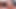 Masturbation