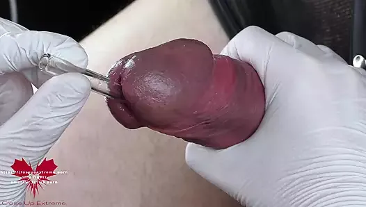 Perfect extraction of sperm directly from the urethra. Close-up of the glass straw sounding.