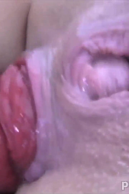 Double Prolapse Dildo