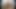LizzyYum February 2024 daily #7 Post Op Orgasm masturbation Pussy teasing