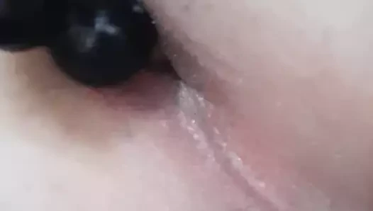 anal