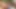 63-year-old Man Wants to Surprise His 23-year-old Lover by Making His Dick Bigger