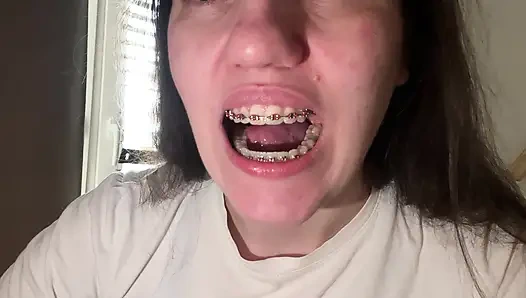 Mit der Zunge die Zahnspangen lecken