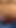 Iconic moment from "Tight foreskin phimosis cock close up dripping precum until cum"