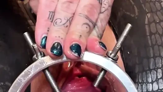 Showing Off My Pumped Cervix