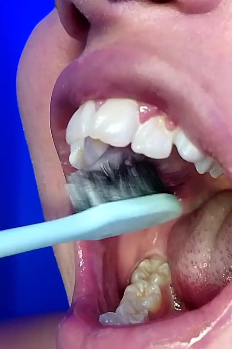 Brushing My Teeth and Showing You My Teeth (close-up)