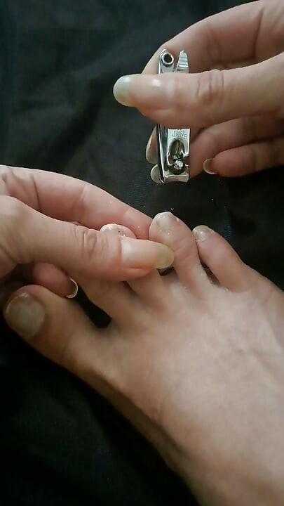 Long Toenail Clipping