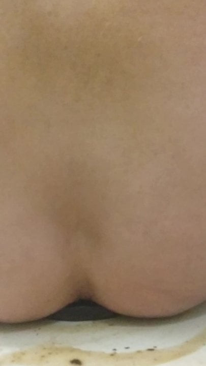 Anal plug