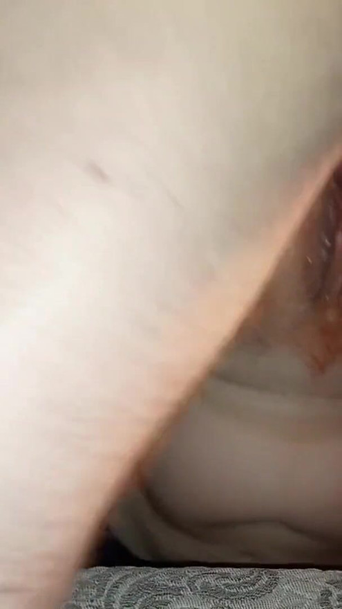 Taming the Jealous: Procedure Number Three.Continuation of treatment | Clip 1