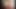 MMS teen age hot girl shot hot sexy video hot beautiful