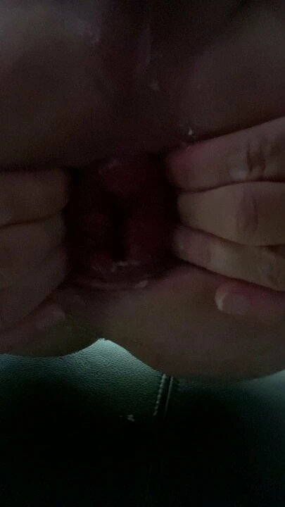 Prolaps