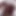 Gaping Hairy Sexy Anus and Lots of Farting